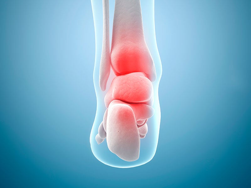 Ankle Pain: Symptoms & Causes