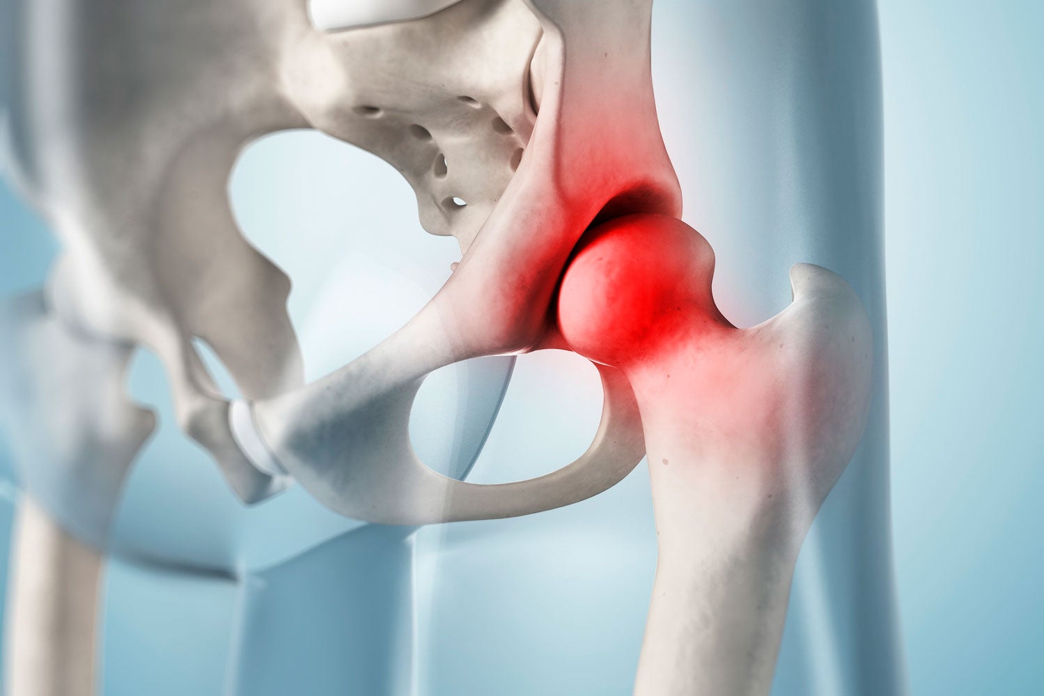 Hip Pain: Symptoms & Causes